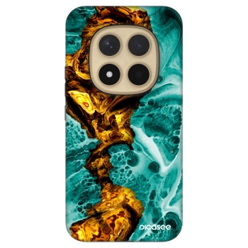 Picasee Fashion Case na Xiaomi Redmi Note 15 Pro+ - Goldsky