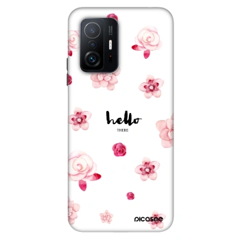 Etui na Xiaomi 11T - Hello there