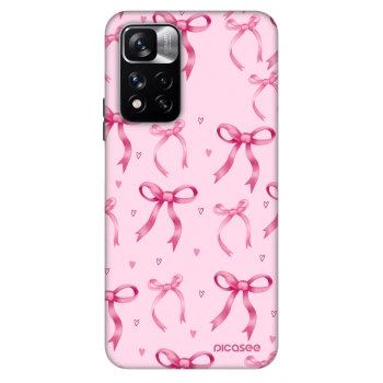 Etui na Xiaomi Redmi Note 11 Pro 5G - Bow Aesthetic