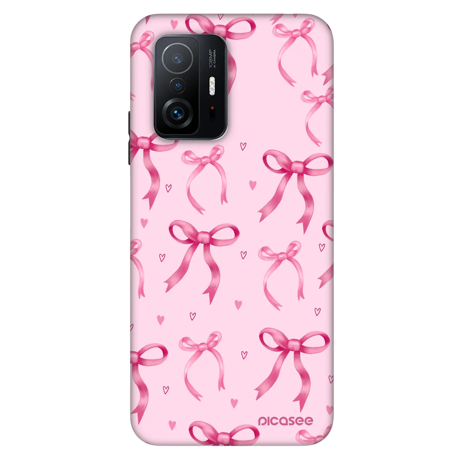 Picasee Fashion Case na Xiaomi 11T - Bow Aesthetic