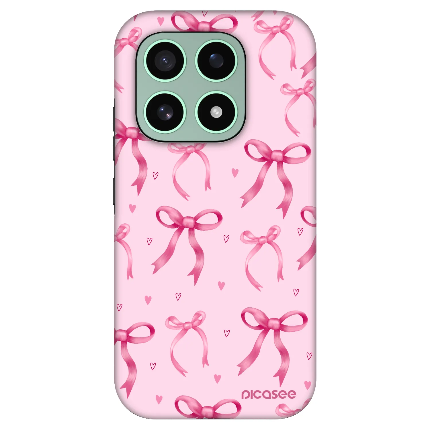 Picasee Fashion Case na Xiaomi 17 - Bow Aesthetic