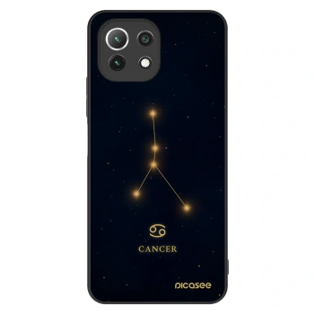 Etui na Xiaomi 11 Lite 5G NE - CANCER